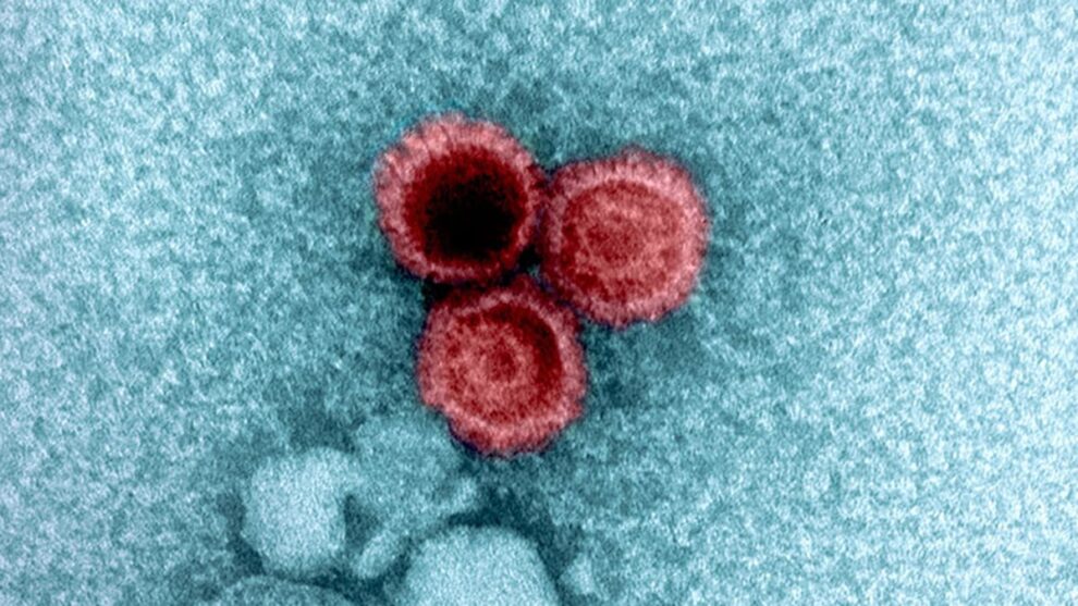 Why Viruses Hide Inside Your Body for Life