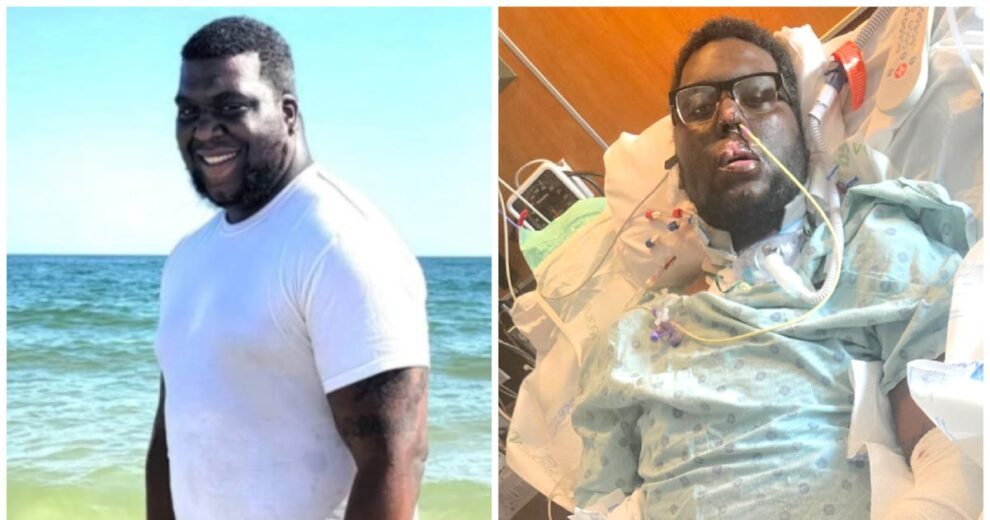 Texas Father's Sepsis After Dental Exam Leads to Triple Amputation