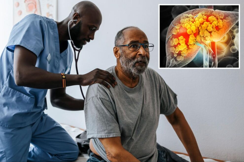 UCLA Fatty Liver Breakthrough Impacts 3M Angelenos