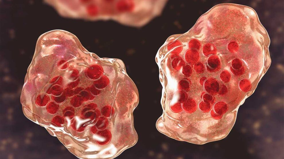 Maryland Measles Case Confirmed in Traveler, Health Officials Warn