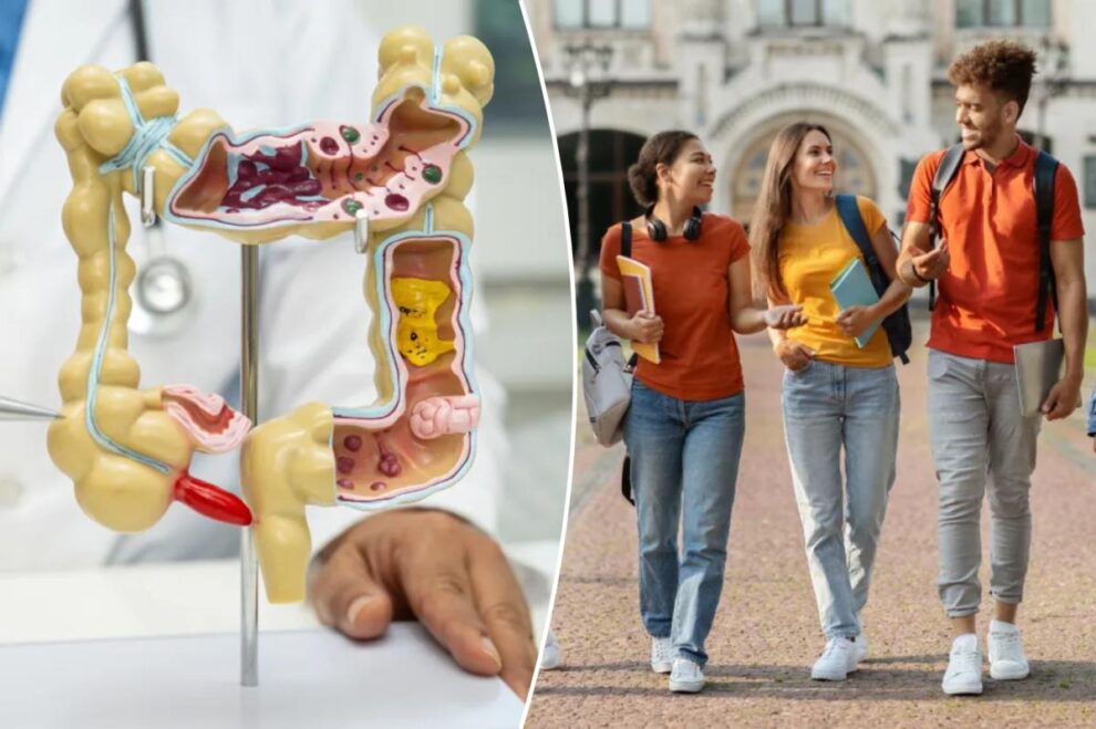Colon Cancer Deaths Rise in Americans Under 50
