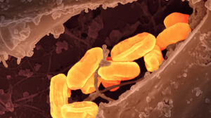 Flea-Borne Typhus Hits Record High in California