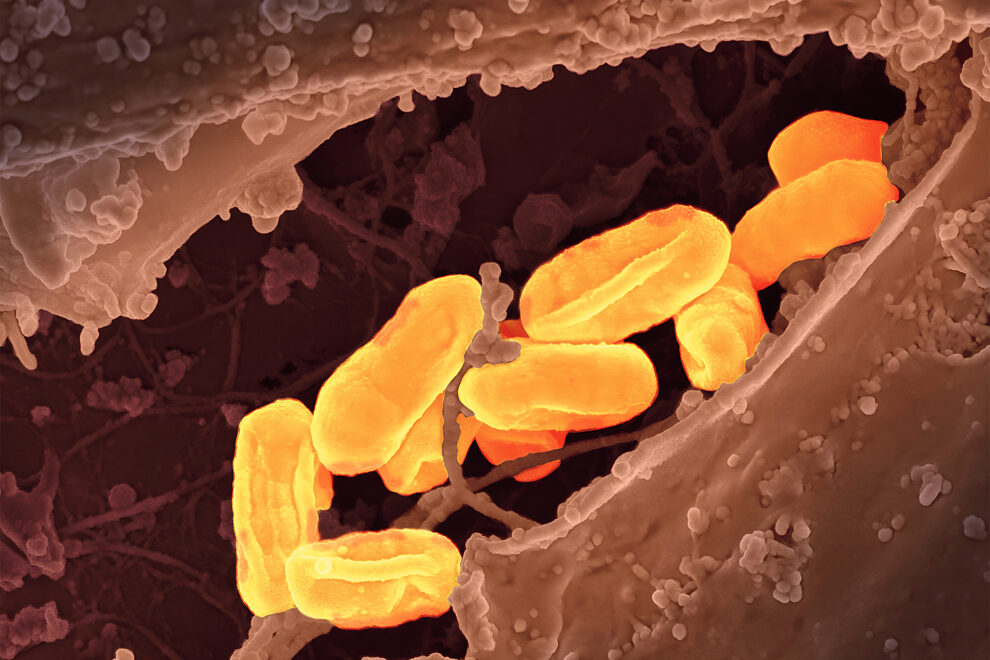 Flea-Borne Typhus Hits Record High in California