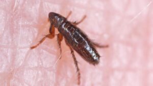 LA County Typhus Outbreak Hits Record Levels, 90% Hospitalized