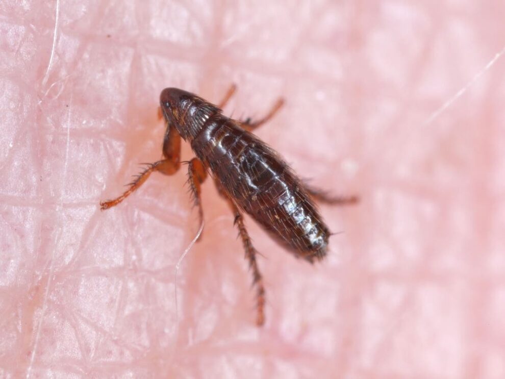 LA County Typhus Outbreak Hits Record Levels, 90% Hospitalized