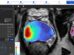 AI prostate cancer treatment at University of Michigan