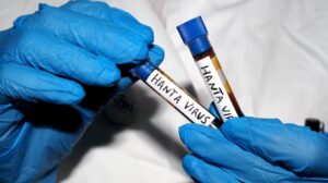 Hantavirus outbreak: American not on cruise feared infected