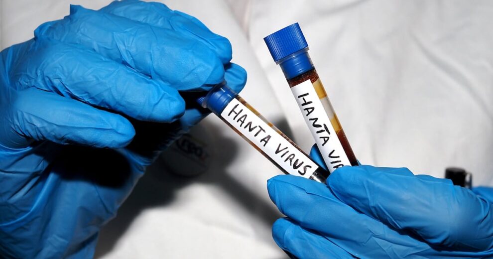Hantavirus outbreak: American not on cruise feared infected