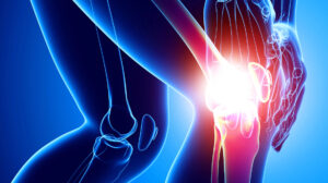 Stanford Scientists Regrow Knee Cartilage: Hope for Arthritis
