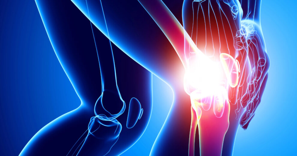 Stanford Scientists Regrow Knee Cartilage: Hope for Arthritis