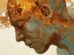 Folate B12 Chronic Fatigue: New Study Reveals Link