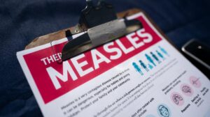 Measles Long Island: Health Officials Warn After Second Case