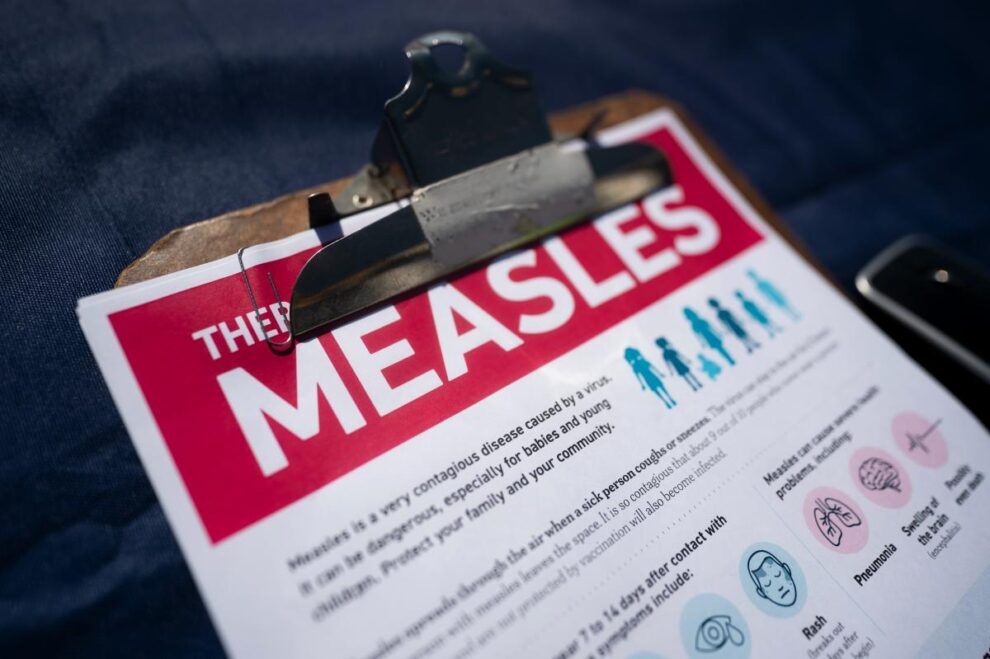 Measles Long Island: Health Officials Warn After Second Case