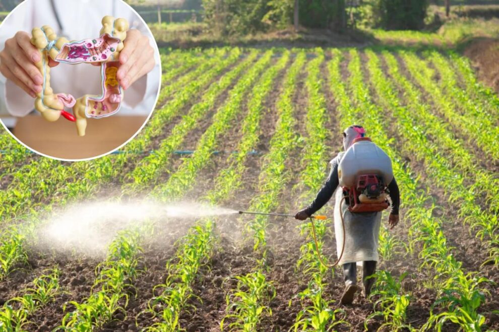 Colorectal Cancer in Young Adults Linked to Weed Killer