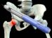 GLP-1s Reduce Fragility Fracture Risk in Diabetic Patients