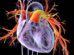Ralinepag Lowers PAH Clinical Worsening Risk in Trial