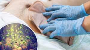 Colorectal Cancer Discovery Could Enable Earlier Diagnosis
