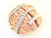 Midlife TV watching linked to brain shrinkage
