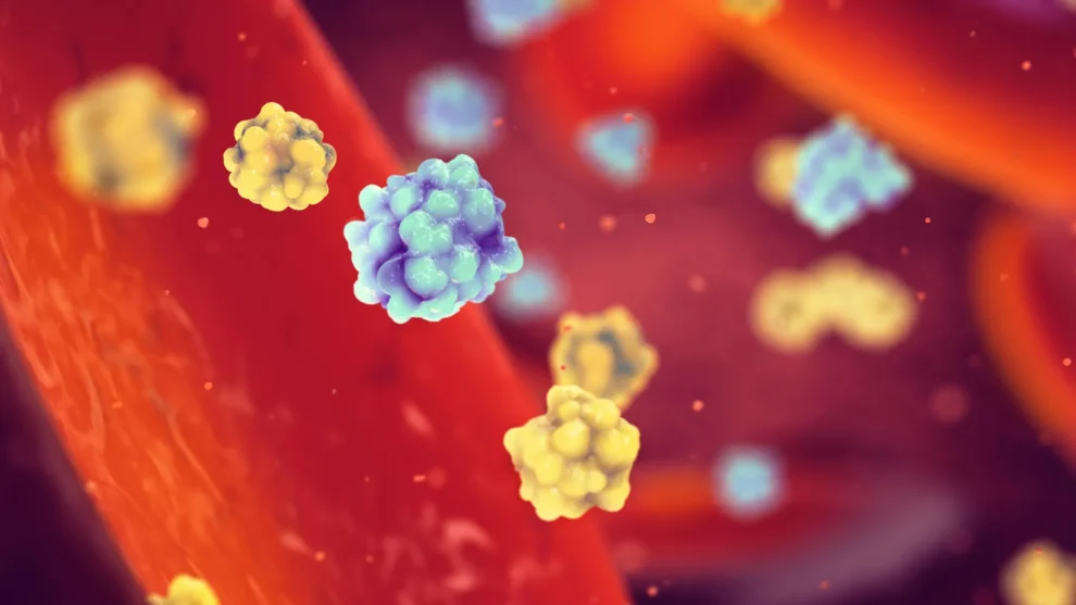 Misfolded Insulin May Silently Trigger Diabetes