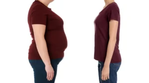 Study Suggests Weight Loss Alone May Not Prevent Type 2 Diabetes