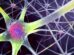 Three Midlife Factors Linked to 13 More Dementia-Free Years