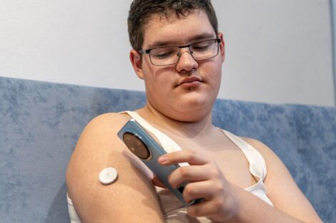 Wide Incidence and Care Gaps in Type 1 Diabetes Across States