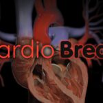 AI ECG Pulmonary Hypertension Detection Advances