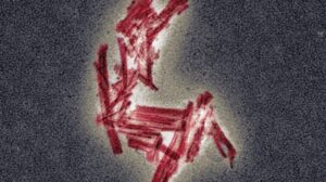 Study Reveals Tau's New Role in Neurodegeneration